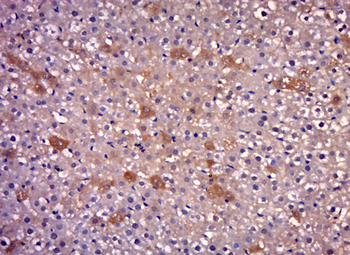 COPZ1 Rabbit Polyclonal Antibody