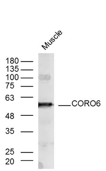 CORO6 Rabbit Polyclonal Antibody