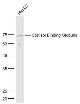 ERPINA6/Cortisol Binding Globulin Rabbit Polyclonal Antibody