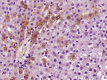 CPS1 Rabbit Polyclonal Antibody