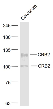 CRB2 Rabbit Polyclonal Antibody