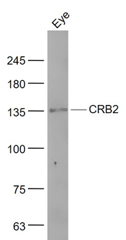CRB2 Rabbit Polyclonal Antibody