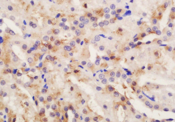 CRB2 Rabbit Polyclonal Antibody