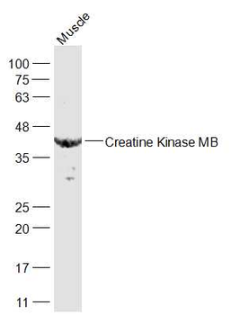 Creatine Kinase MB Rabbit Polyclonal Antibody