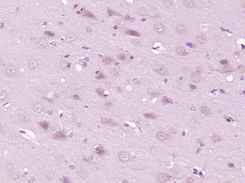 Creatine kinase MT Rabbit Polyclonal Antibody