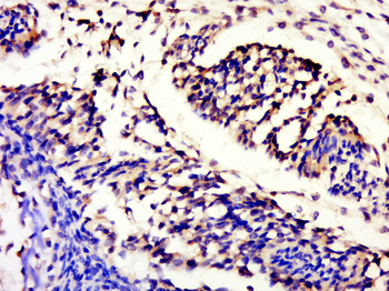 CRIP2 Rabbit Polyclonal Antibody