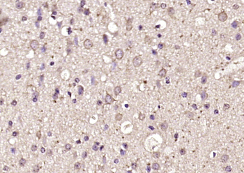 CRLF3 Rabbit Polyclonal Antibody