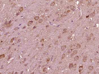 Phospho-CRMP2 (Thr509) Rabbit Polyclonal Antibody