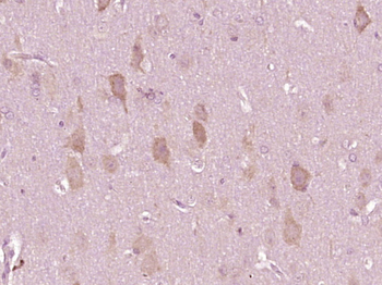Phospho-CRMP2 (Thr509) Rabbit Polyclonal Antibody