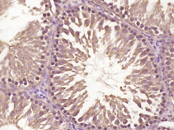 Phospho-CRMP2 (Thr509) Rabbit Polyclonal Antibody