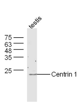 Centrin 1 Rabbit Polyclonal Antibody
