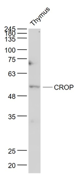 CROP Rabbit Polyclonal Antibody