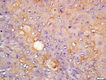 Cytokeratin 6 Rabbit Polyclonal Antibody