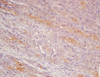 Cytokeratin 6 Rabbit Polyclonal Antibody