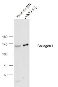 Collagen I Rabbit Polyclonal Antibody
