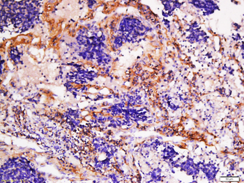 Collagen I Rabbit Polyclonal Antibody