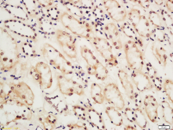 CSB Rabbit Polyclonal Antibody