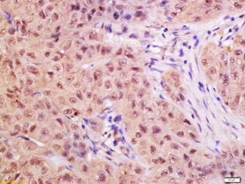 CTDSP2 Rabbit Polyclonal Antibody