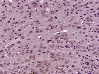 CTU2 Rabbit Polyclonal Antibody