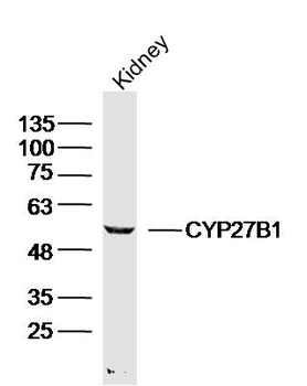CYP27B1 Rabbit Polyclonal Antibody