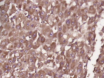 CYP8B1 Rabbit Polyclonal Antibody