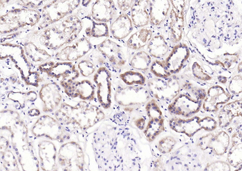 Claudin 5 Rabbit Polyclonal Antibody