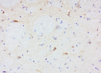 COX4I1 Rabbit Polyclonal Antibody