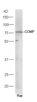 COMP Rabbit Polyclonal Antibody