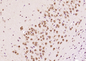 CUG-BP1/2 Rabbit Polyclonal Antibody