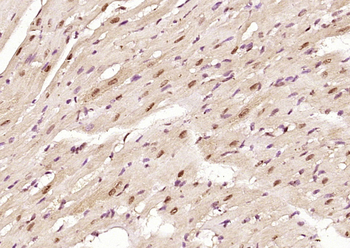 CUG-BP1/2 Rabbit Polyclonal Antibody