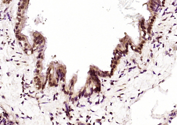 CUG-BP1/2 Rabbit Polyclonal Antibody