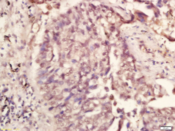 CUG-BP1/2 Rabbit Polyclonal Antibody