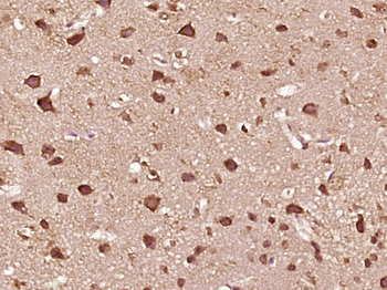 FLIP Rabbit Polyclonal Antibody