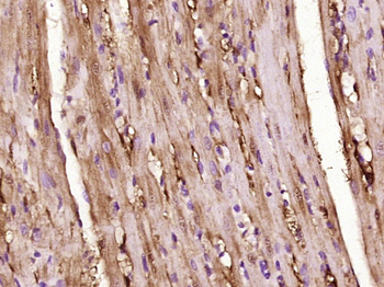 FLIP Rabbit Polyclonal Antibody