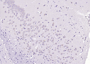 CRHR1 Rabbit Polyclonal Antibody