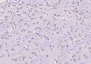CRHR1 Rabbit Polyclonal Antibody