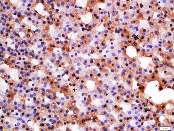 CRHR1 Rabbit Polyclonal Antibody