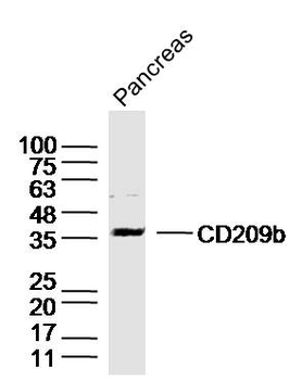 DC-SIGNR1/CD209b Rabbit Polyclonal Antibody