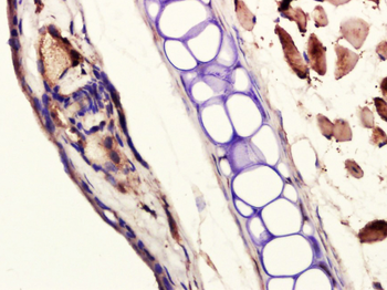 Collagen II Rabbit Polyclonal Antibody