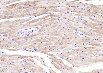 Cardiac Troponin T Rabbit Polyclonal Antibody