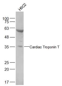 Cardiac Troponin T Rabbit Polyclonal Antibody