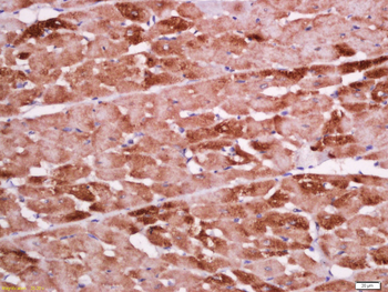 Cardiac Troponin T Rabbit Polyclonal Antibody