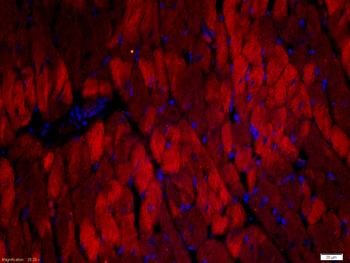 Cardiac Troponin T Rabbit Polyclonal Antibody