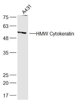 HMW Cytokeratin Rabbit Polyclonal Antibody