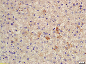 CES1/Liver Carboxylesterase 1 Rabbit Polyclonal Antibody