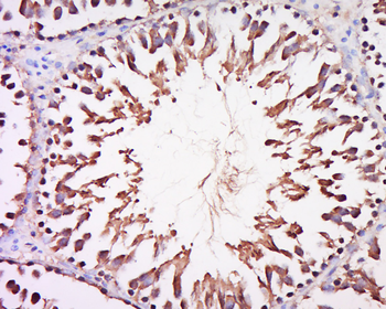 DARS2 Rabbit Polyclonal Antibody