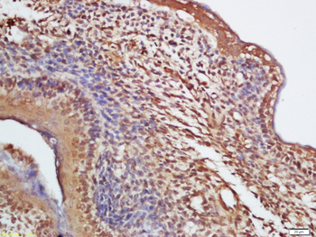 DBR1 Rabbit Polyclonal Antibody