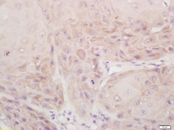 DSPP Rabbit Polyclonal Antibody