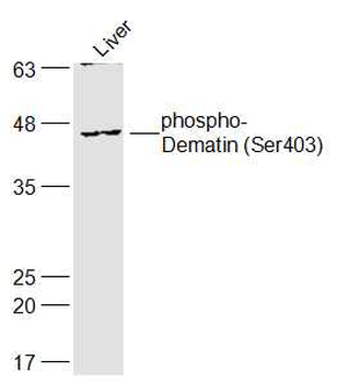Phospho-Dematin (Ser403) Rabbit Polyclonal Antibody