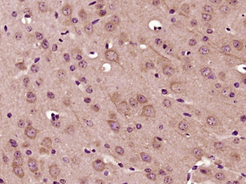 DENN Rabbit Polyclonal Antibody